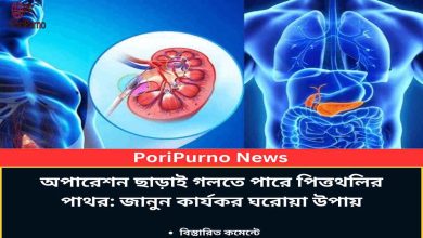 dissolve gallstones without surgery