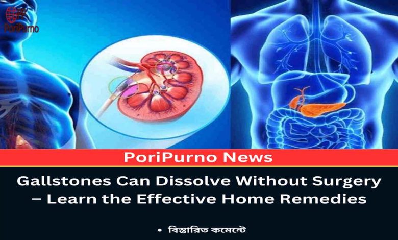 gallstone natural treatment guide