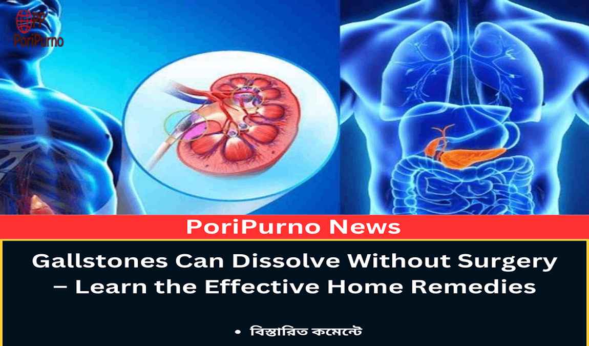 gallstone natural treatment guide